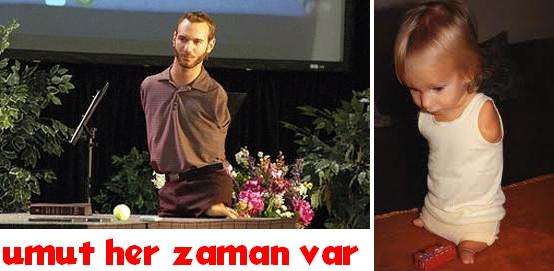 Umut Her Zaman Var… VİDEO