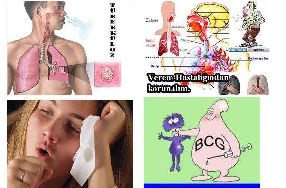 01-07 Ocak Verem Savaş Haftası