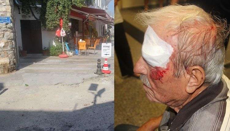 Rifat Ağan Tekerlekli Sandalye ile Bozuk Kaldırımdan Düşerek Yaralandı?