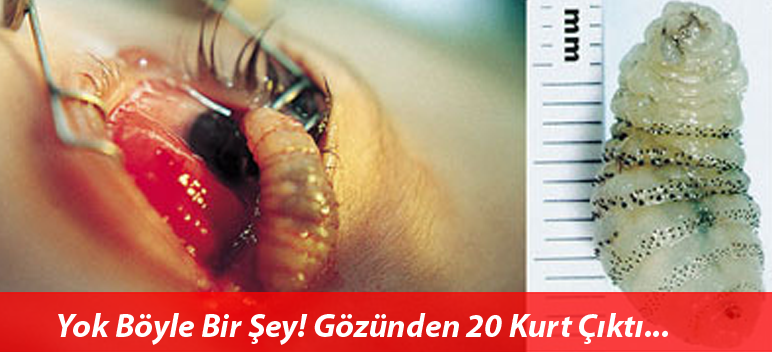 Yok Böyler Bir Şey! Gözünden 20 Tane Kurt Çıktı